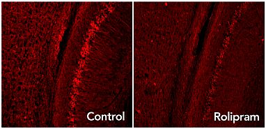 Brain images show rolipram panel with less bright red dots than control panel.