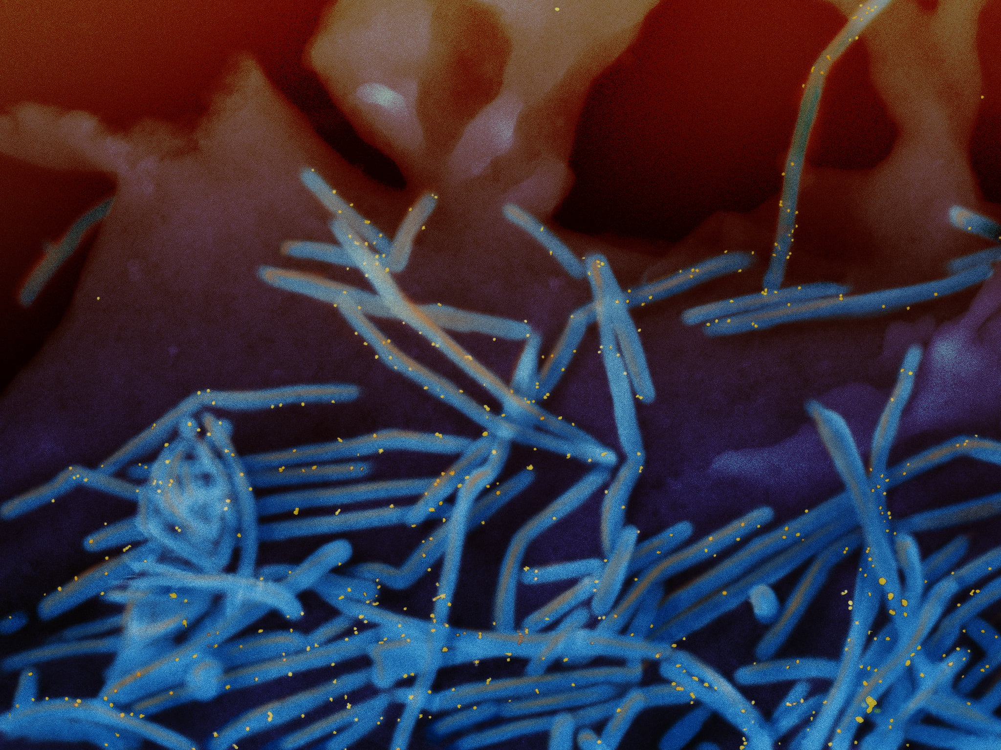 Experimental respiratory syncytial virus vaccine prompts antibody surge ...