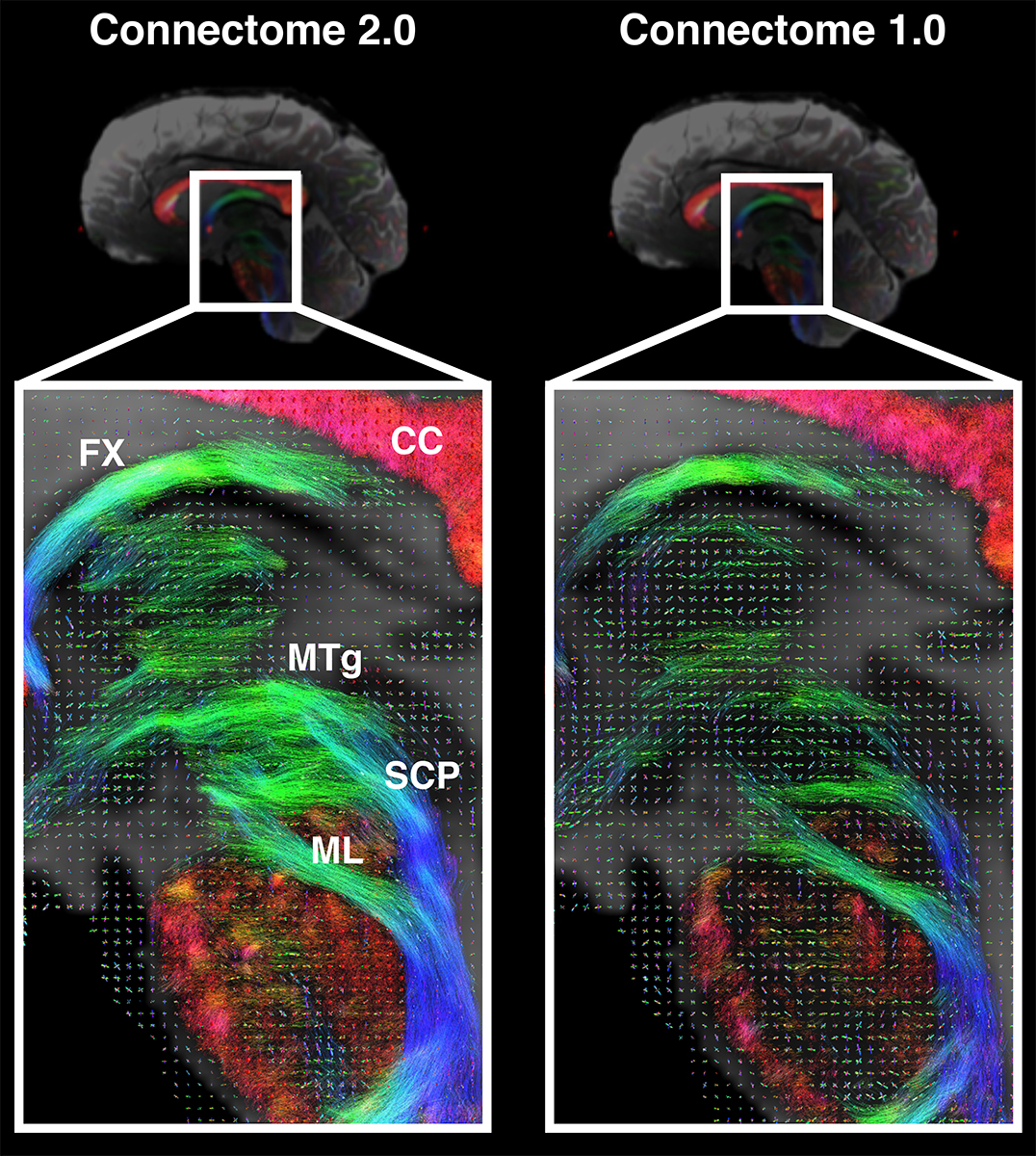 高性能MRIスキャナーで脳内の微細構造を可視化(Scientists Develop High-Performance MRI Scanner in Effort to Define Microscopic Brain Structures)