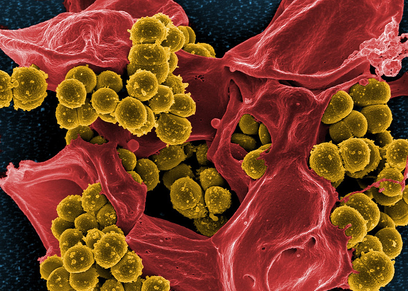 黄色ブドウ球菌血流感染症に新療法(Two-dose therapy for S. aureus bloodstream infections on par with standard treatment)