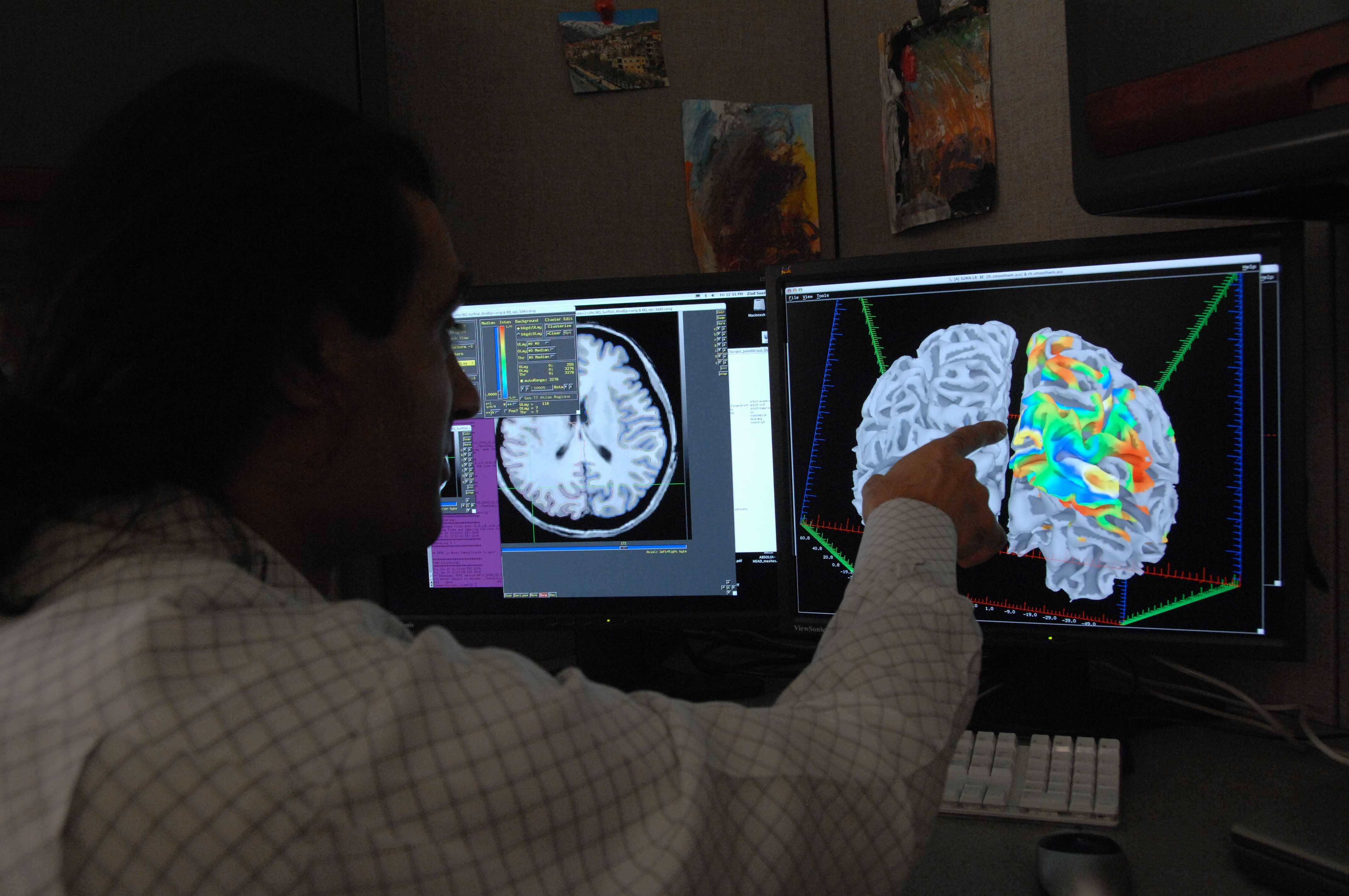 Researcher with brain imaging data.
