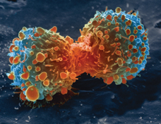 Colored scanning electron micrograph of a lung cancer cell during cell division.