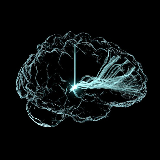 Deep Brain Stimulation Illustration