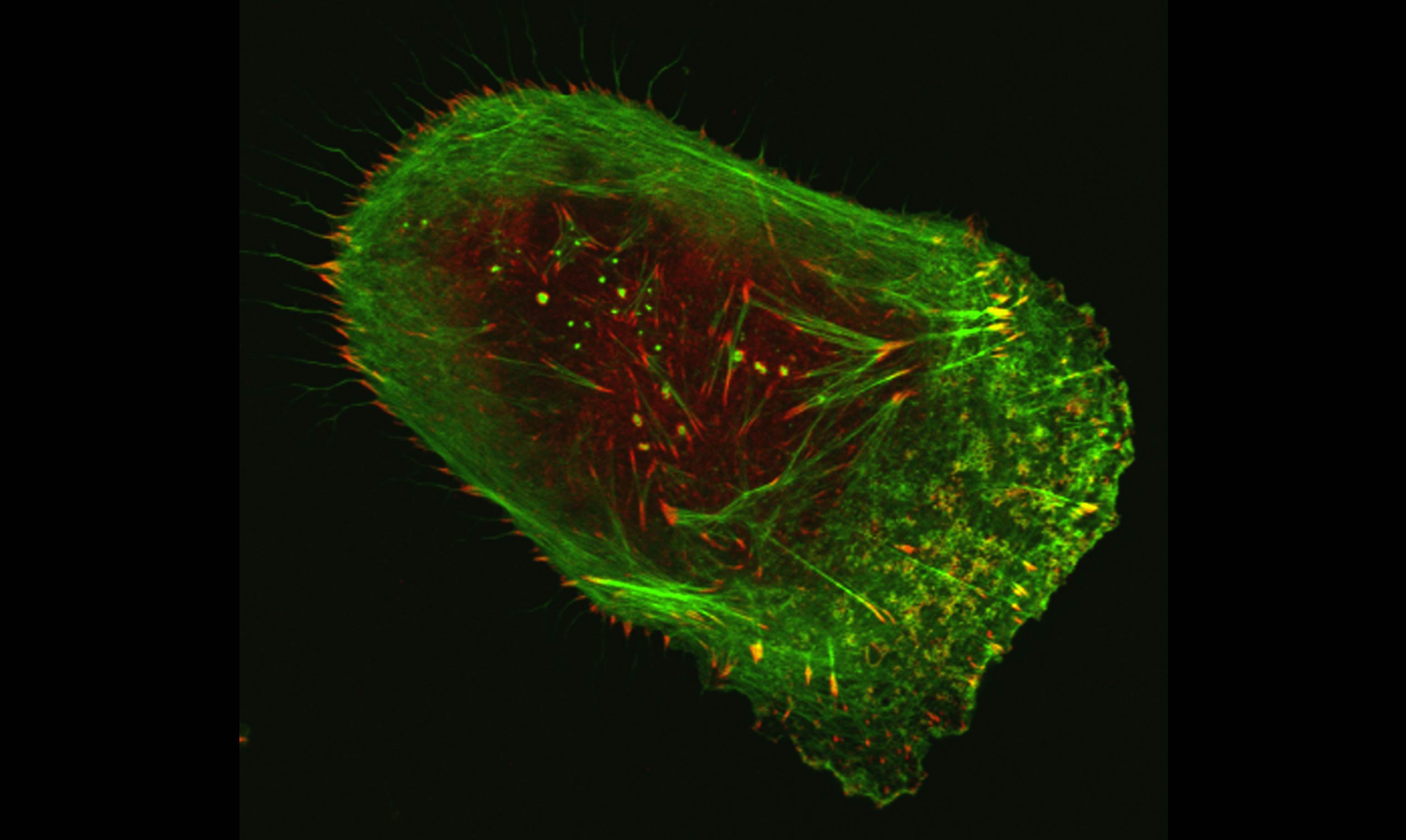 Human malignant melanoma cell viewed through a fluorescent, laser-scanning confocal microscope.