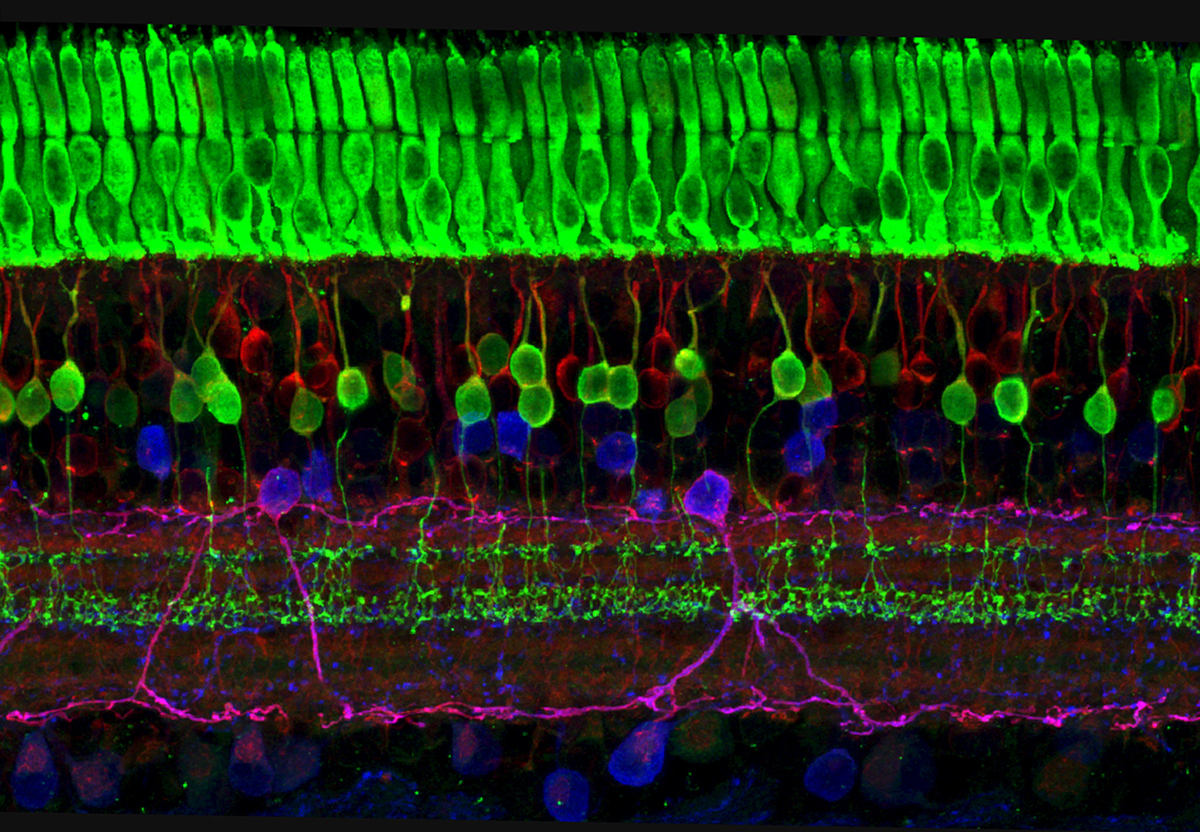 Image capturing the layers of nerve cells in the retina. The top layer (green) is made up of cells called photoreceptors that convert light into electrical signals to relay to the brain.