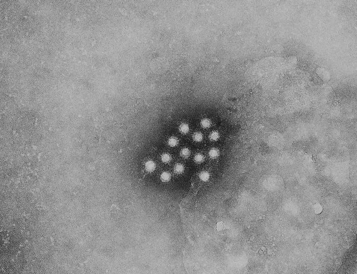 Transmission electron micrograph of a small cluster of the ribonucleic acid (RNA) hepatitis A virus (HAV).