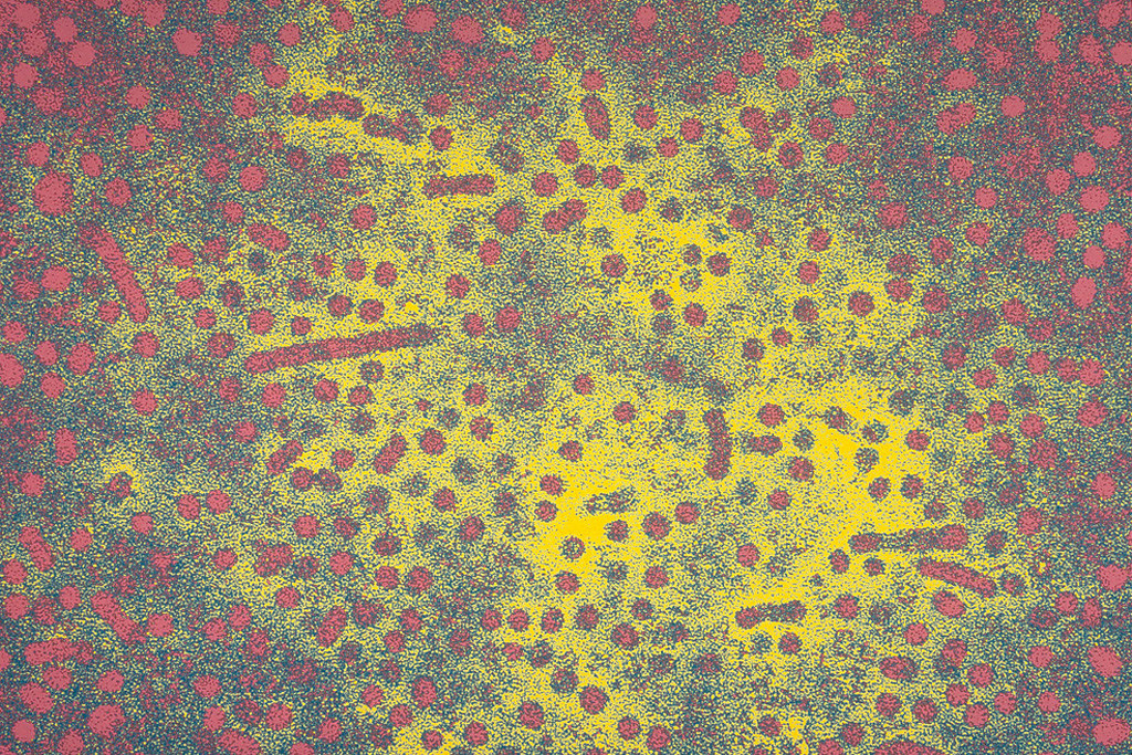 Electron microscope image of the hepatitis B virus (HBV).
