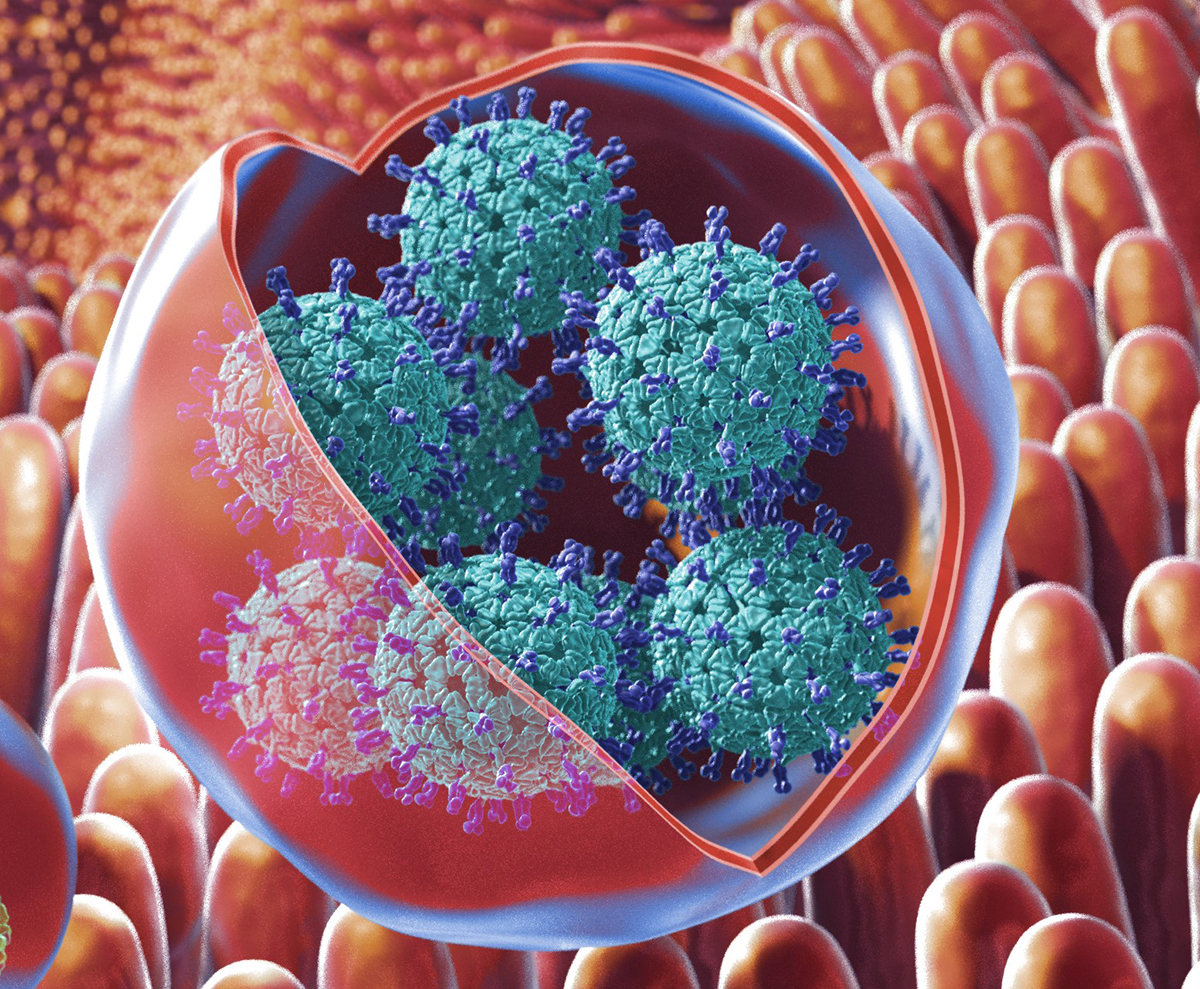 Illustration of membrane-bound vesicles containing clusters of rotavirus within the gut. Researchers have found that these viruses that cause severe stomach illness get transmitted to humans through membrane-cloaked “virus clusters” that exacerbate the sp