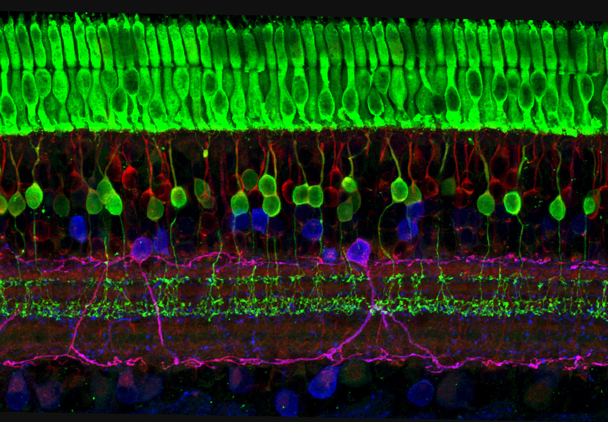 Eye and Ear Health Image capturing the layers of nerve cells in the retina. The top layer (green) is made up of cells called photoreceptors that convert light into electrical signals to relay to the brain.