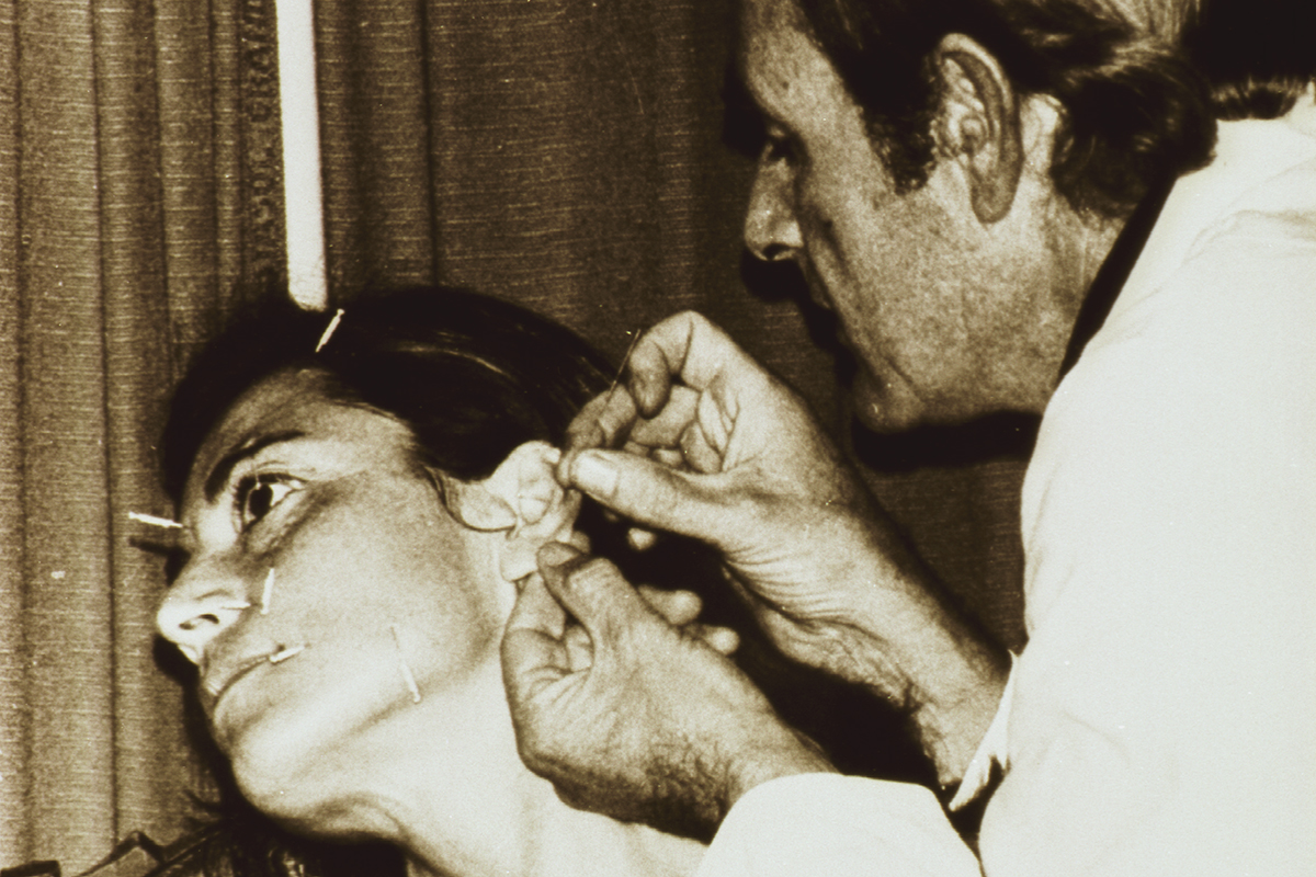 A physician is inserting needles into a woman's ear; other needles have been placed at various points on her face A physician is inserting needles into a woman's ear; other needles have been placed at various points on her face