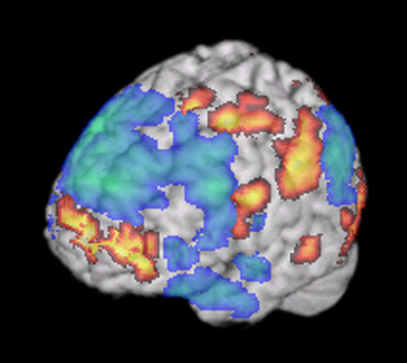Functional Brain Imaging Brain image from a functional MRI scan when a person was listening to improvised jazz music.