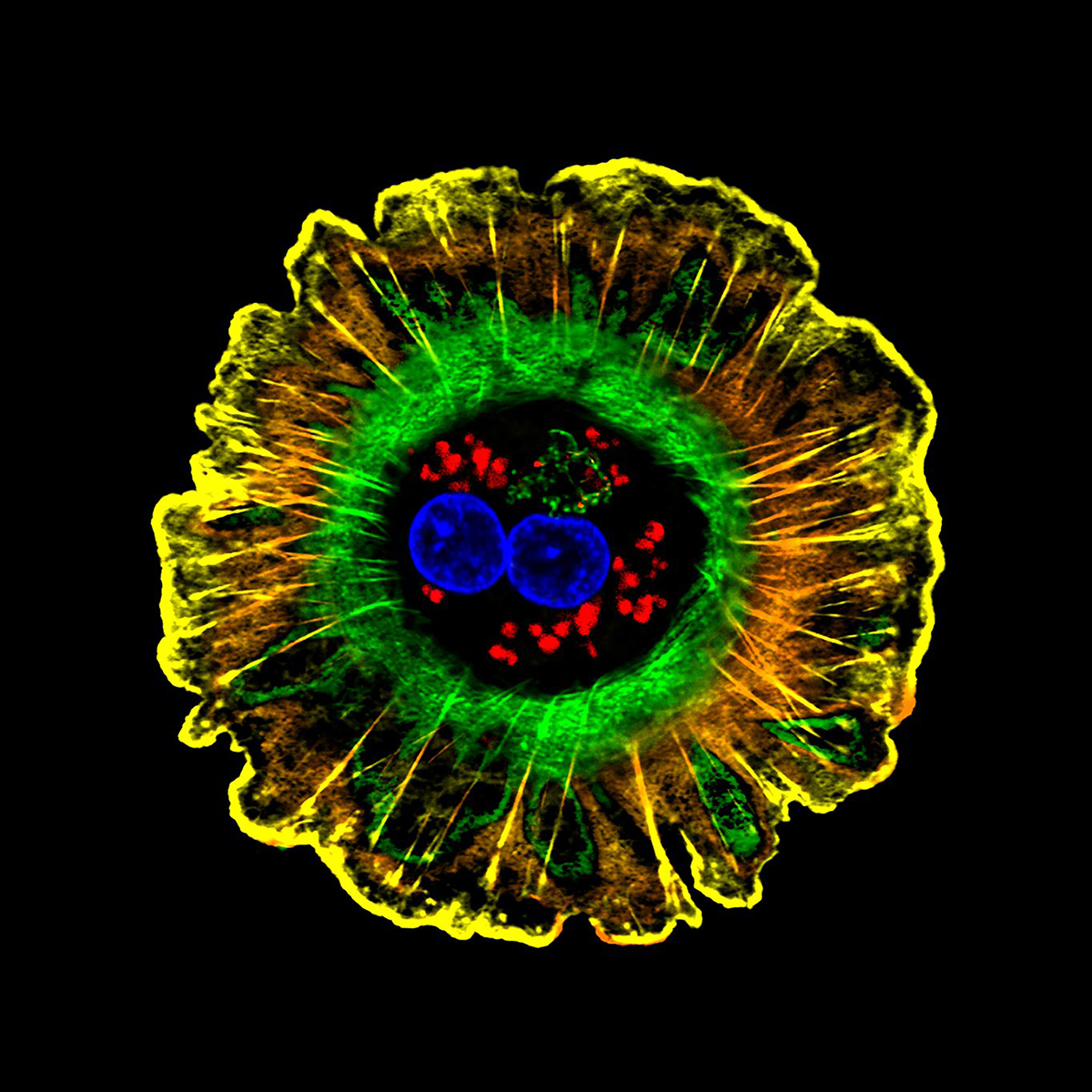 Single human liver cell on a black background.