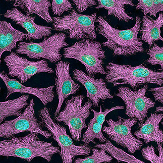 Multiphoton fluorescence image of HeLa cells