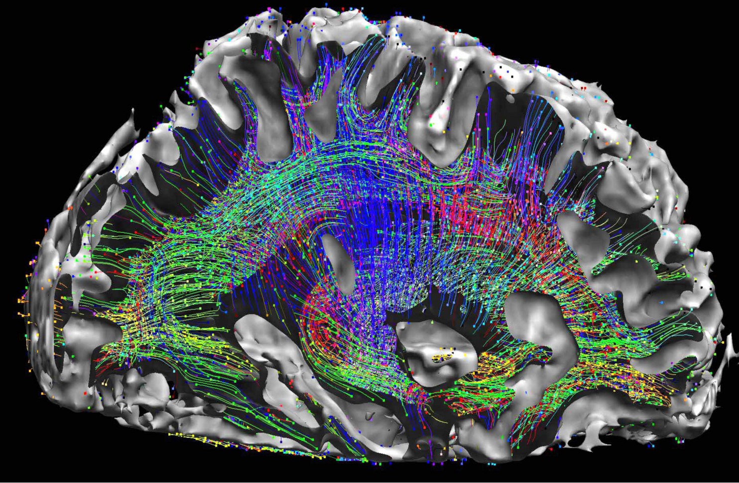 Illustration of a human brain.