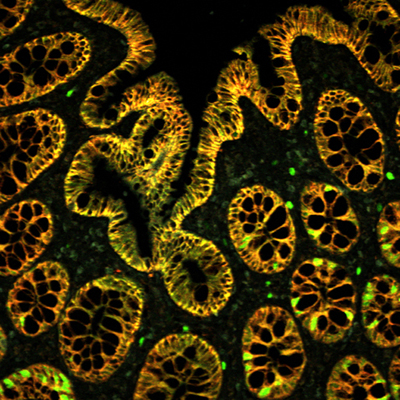 Image of colon tissue and nano-particles