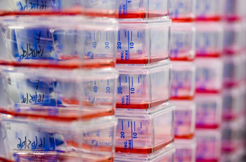 Steering a New Course for Stem Cell Research Photo of stem cell culture vials
