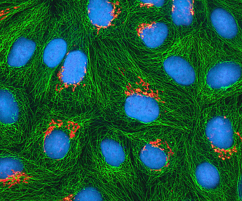 Multiphoton fluorescence image of cultured HeLa cells