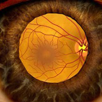Illustration showing the retina as seen through a dilated pupil.
