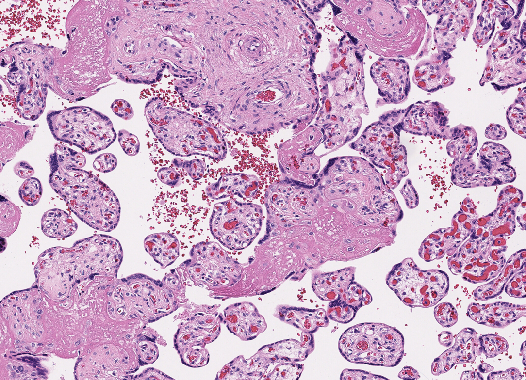 Screenshot from the COVID Digital Pathology Repository