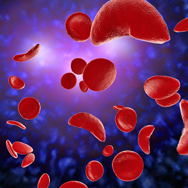 An illustration of sickle cells
