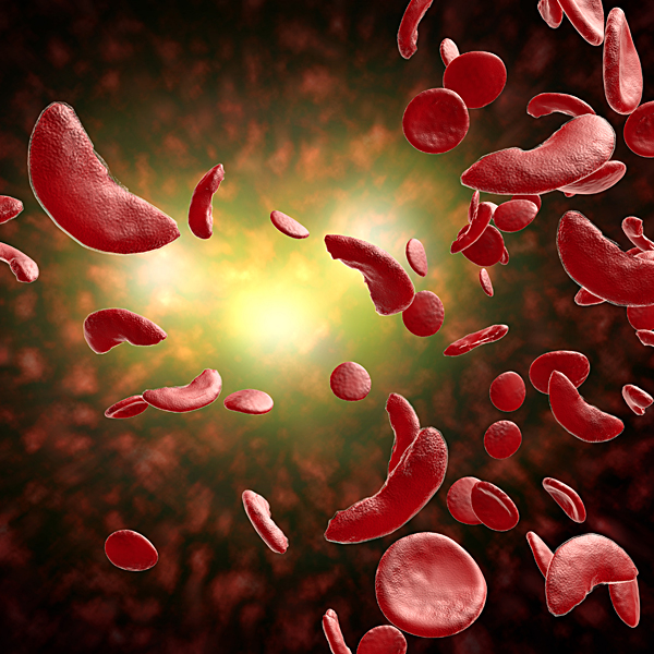 An illustration of sickled blood cells and healthy blood cells