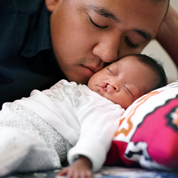 A sleeping baby with a cleft palate being cuddled by her father