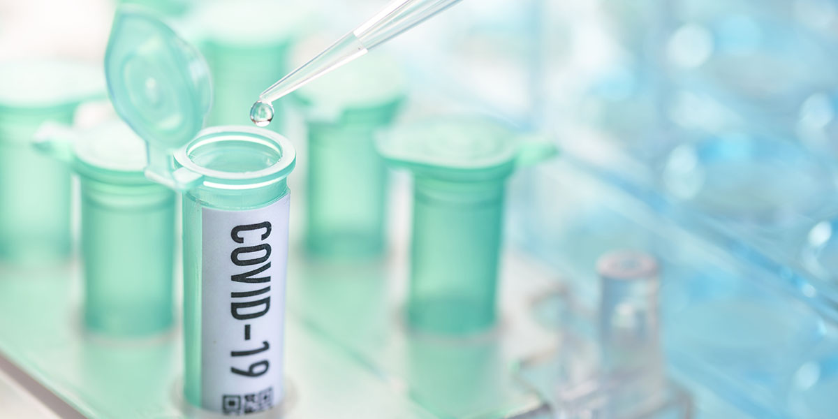 Rapid Acceleration of Diagnostics (RADx) Coronavirus: vial with pipette in laboratory.