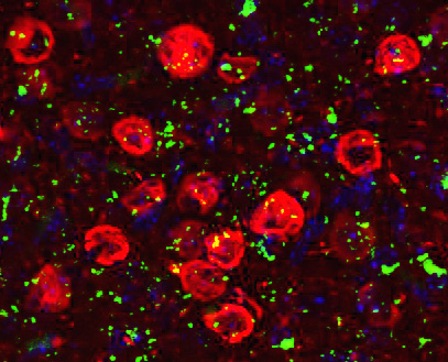Image of a mouse brain used to study Alzheimer’s disease. Image of a mouse brain used to study Alzheimer’s disease.