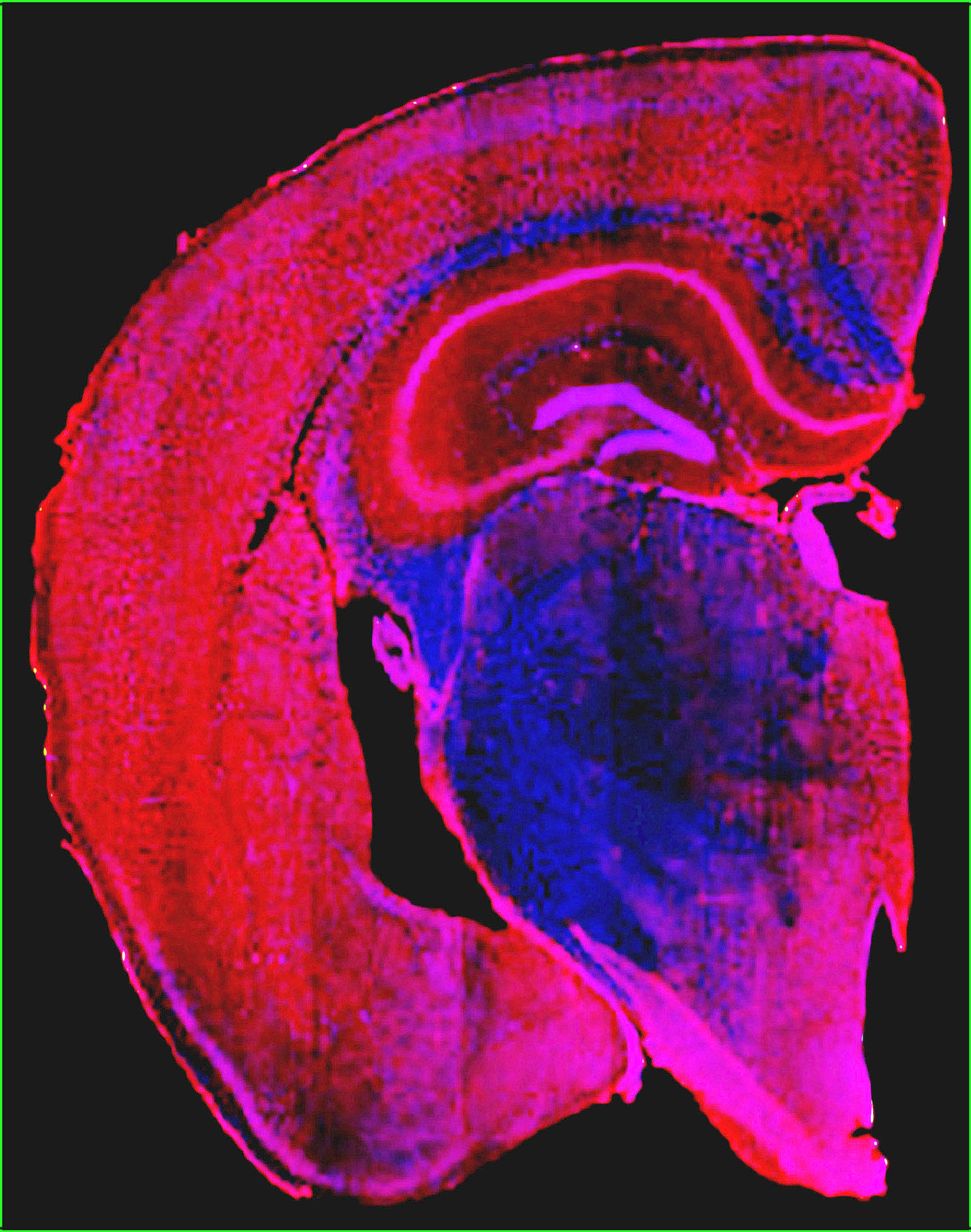 Image of a mouse brain scan