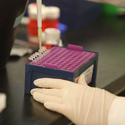 Image of a researcher using a pipet