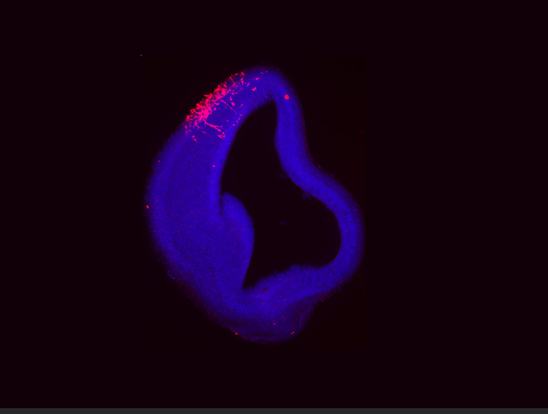 Image of a fetal mouse brain
