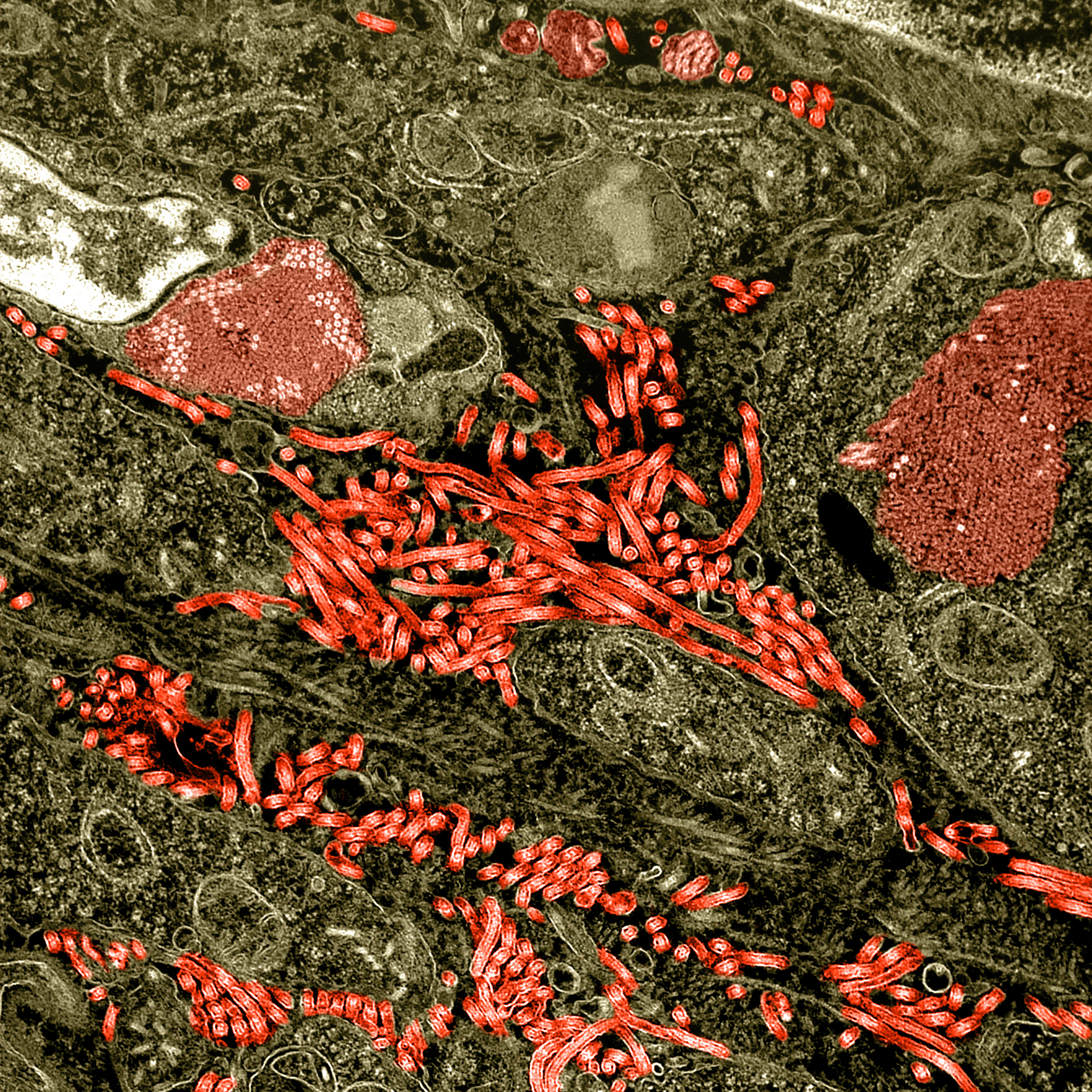 Colorized transmission electron micrograph of the ovary from a nonhuman primate infected with Ebola virus.