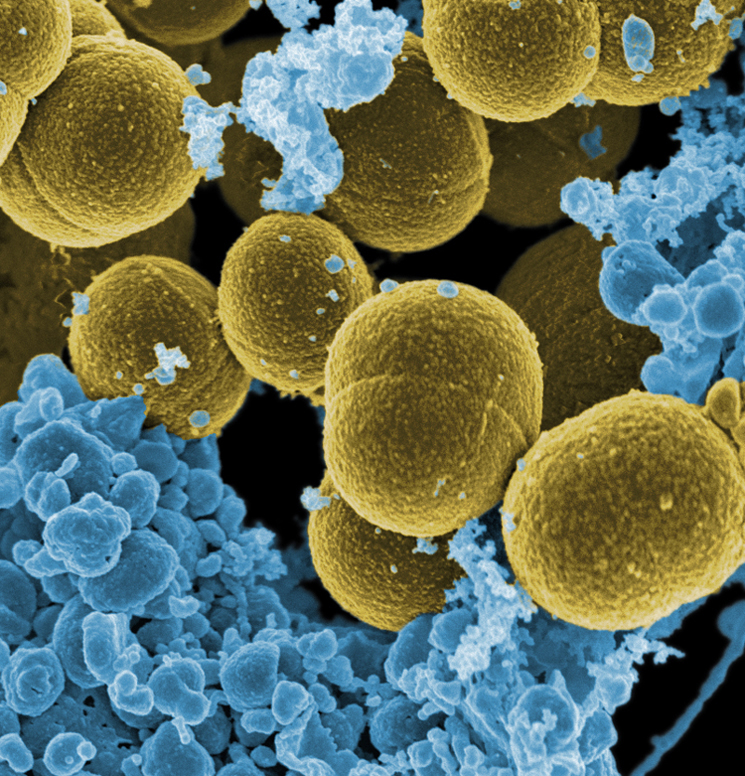 S. aureus bacteria escaping destruction by human white blood cells