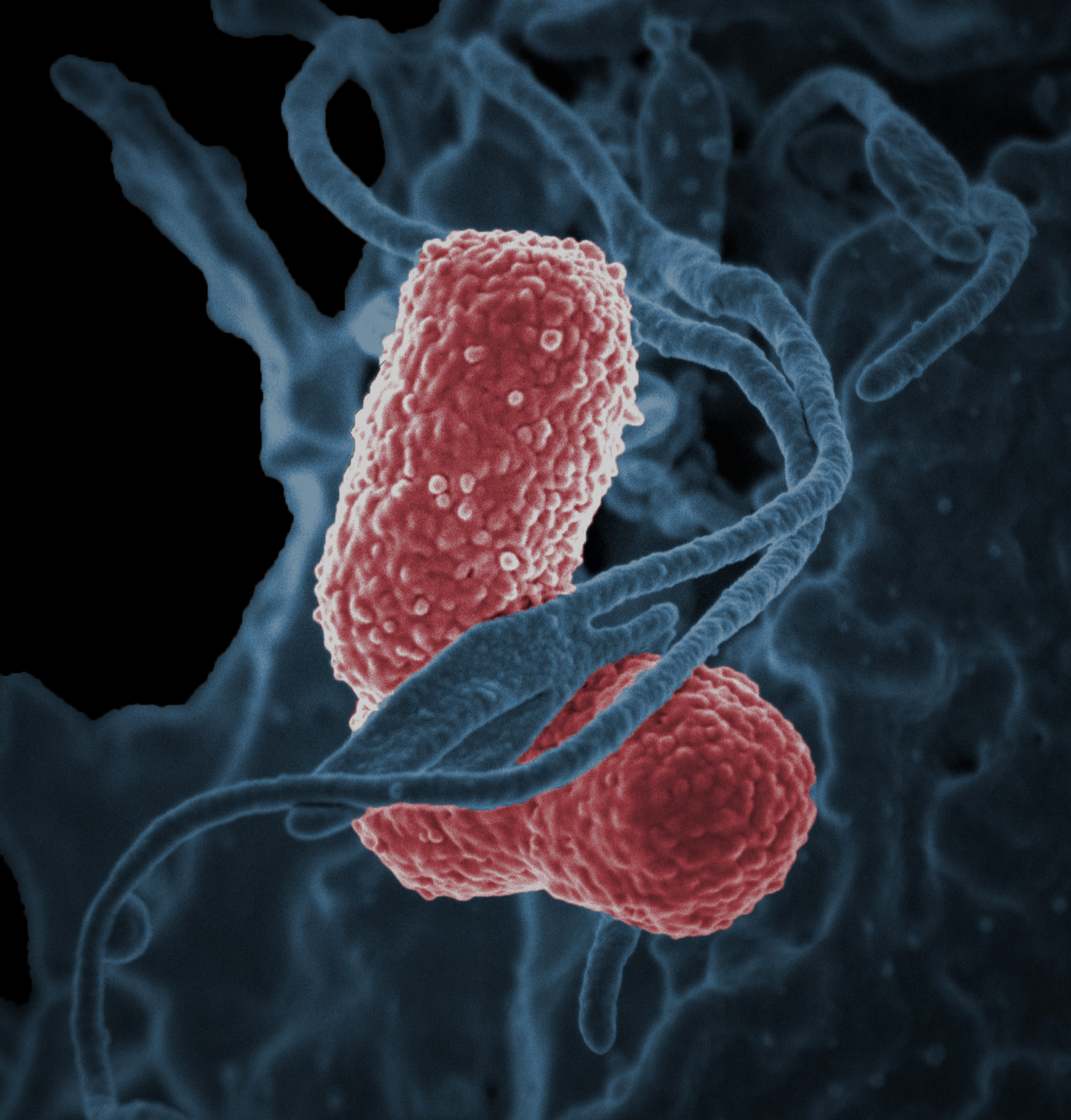Image of Klebsiella bacteria. 