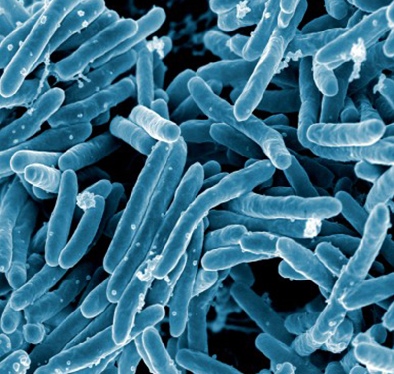 Scanning electron micrograph of Mycobacterium tuberculosis bacteria, which cause tuberculosis.