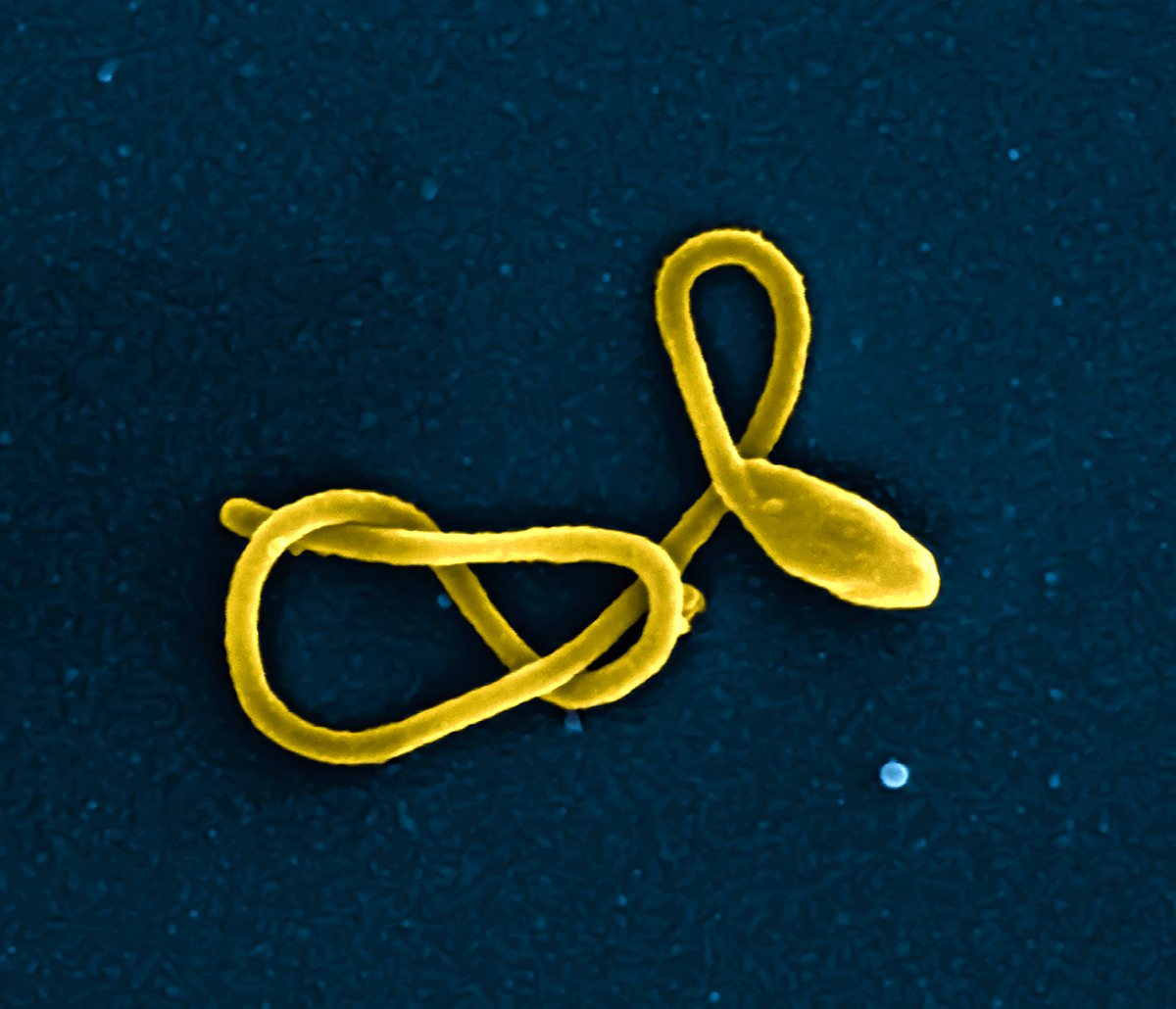 Image of Ebola virus particle
