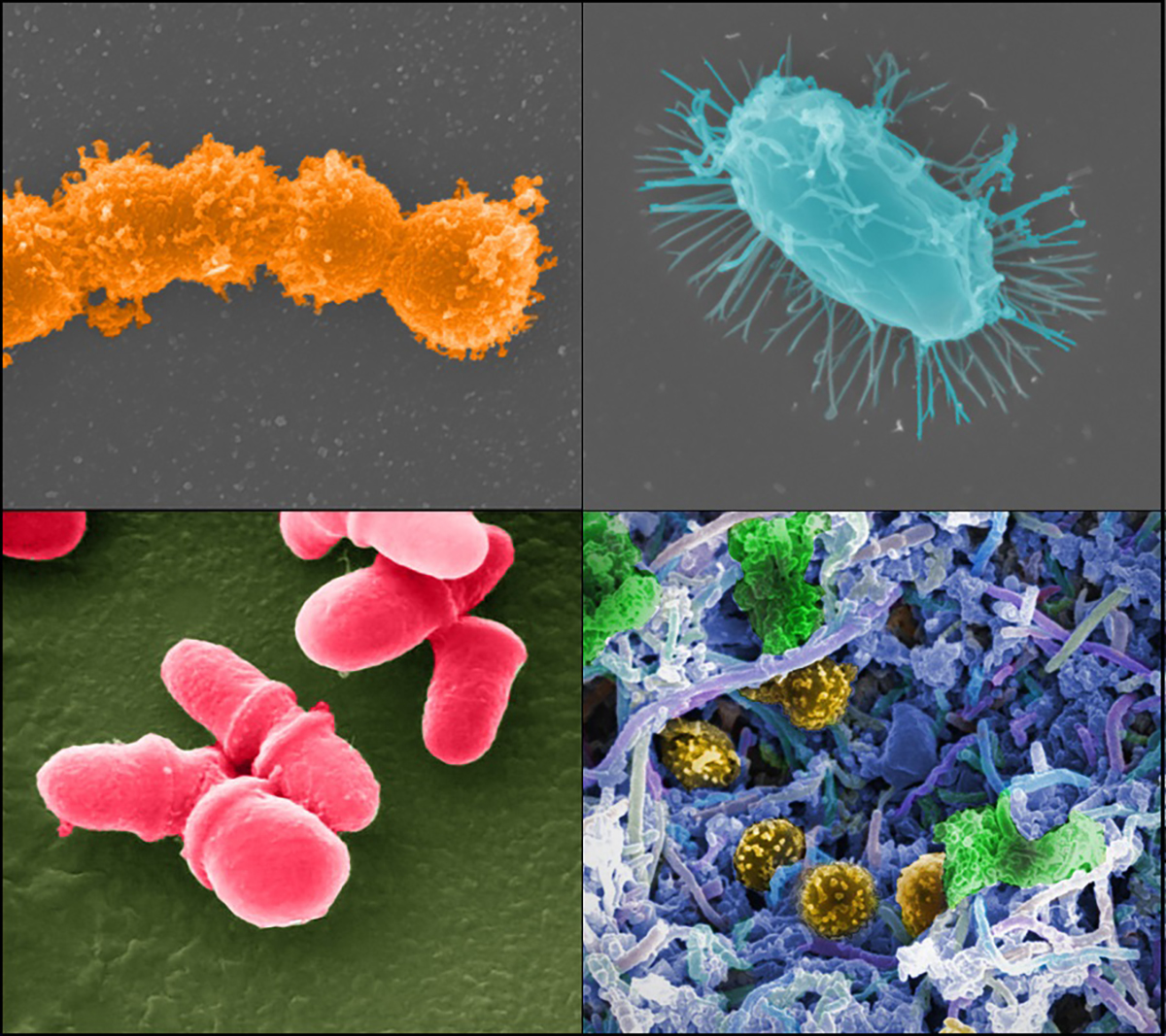 : Microscopic images of bacteri