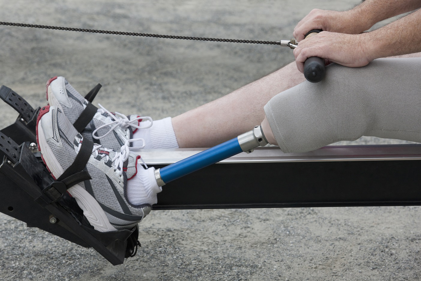 Image of a prosthetic leg