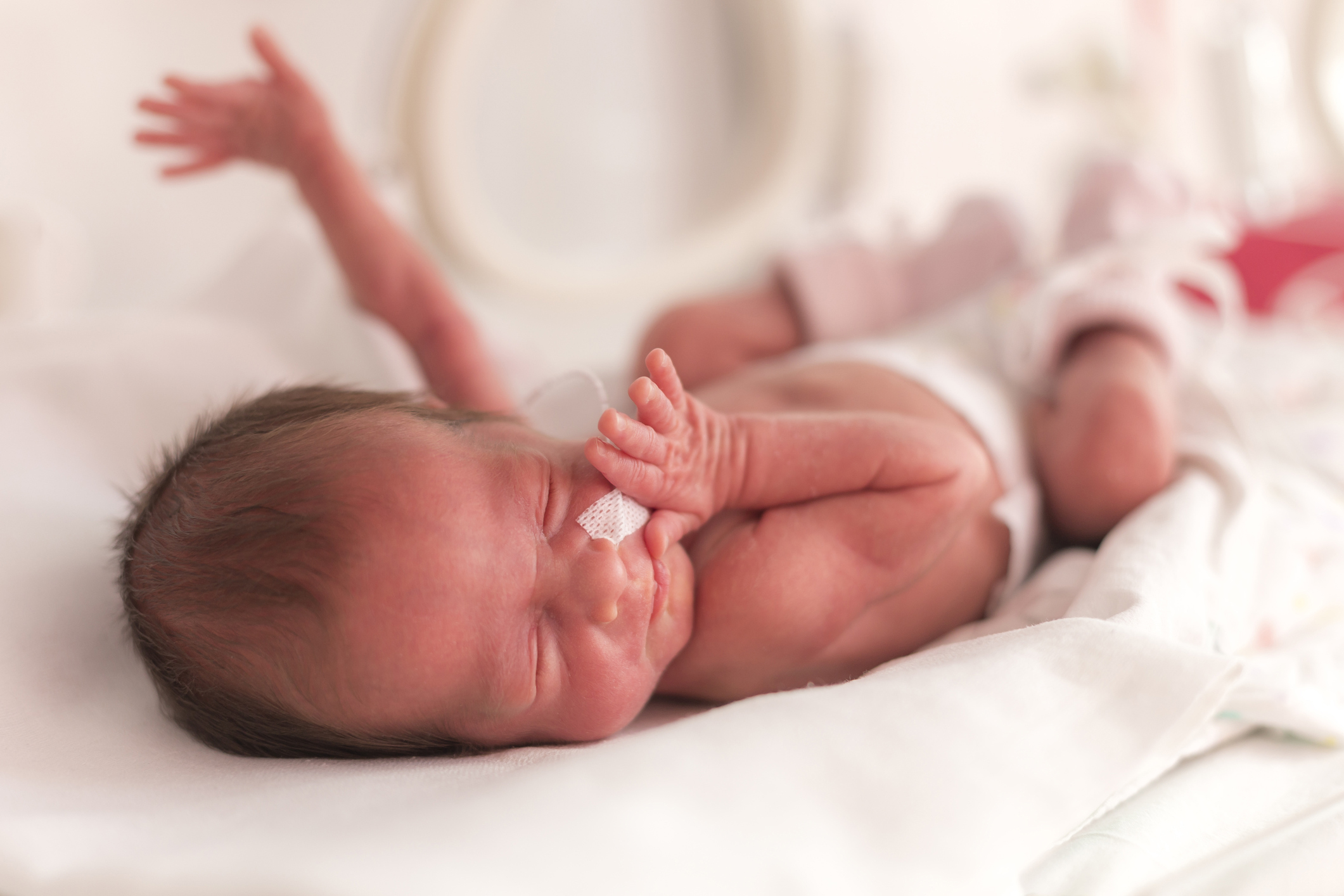 Image of premature infant.