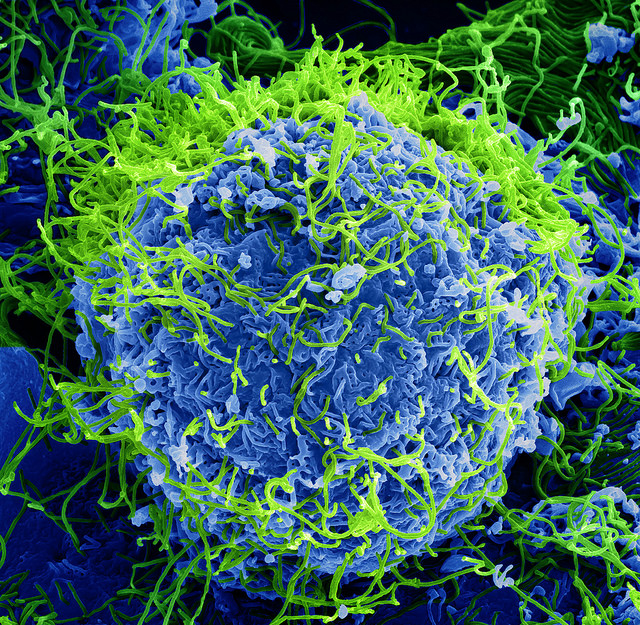 Ebola virus particles.