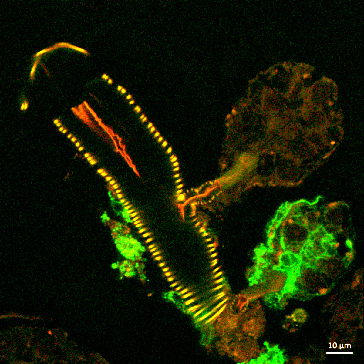 Microscopic image of a tick salivary gland