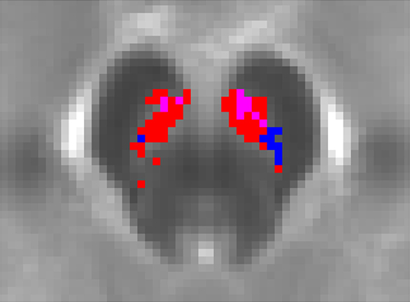 Digital images of NM-MRI brain scans.