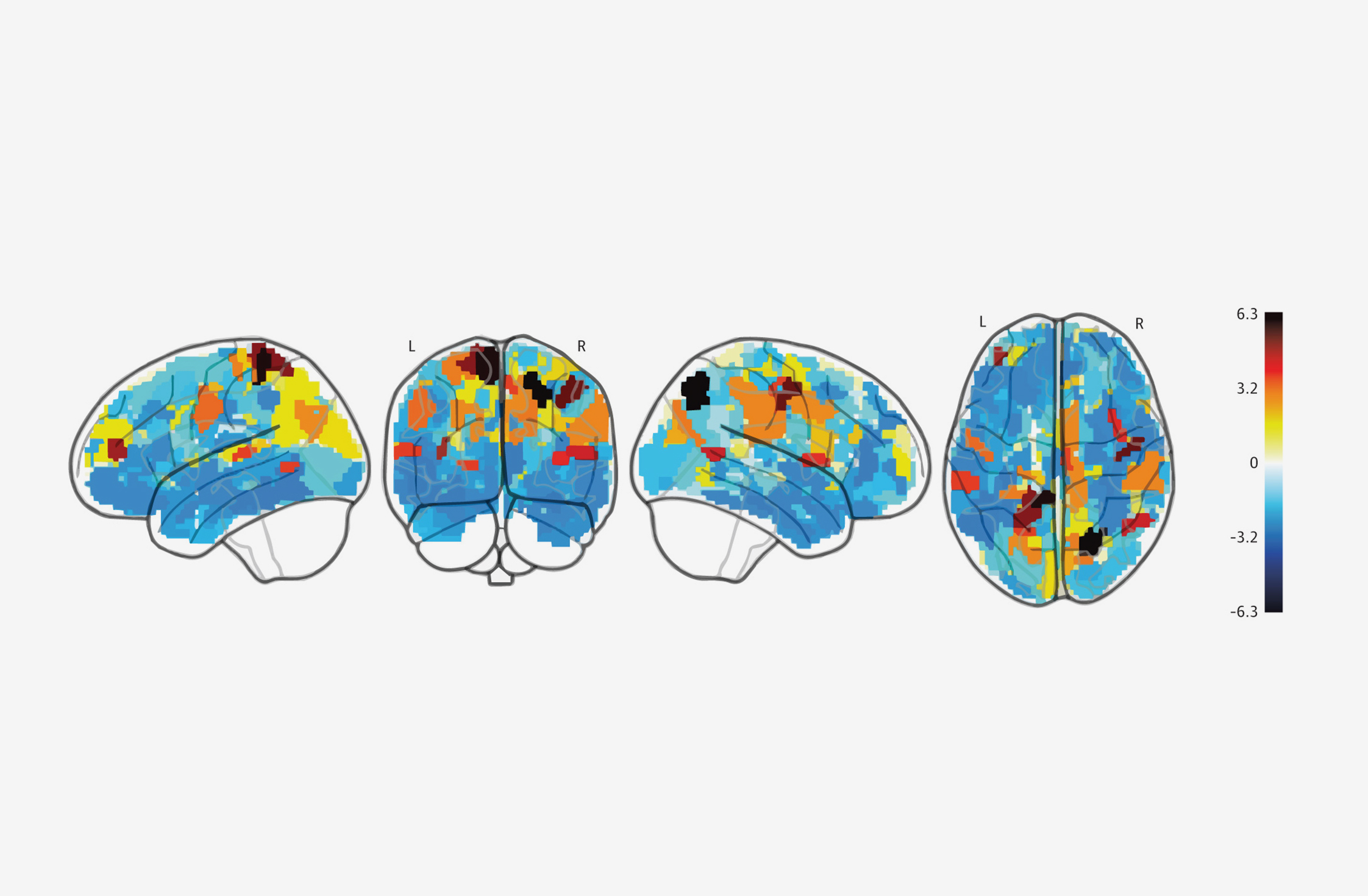 Illustration of brain activity 