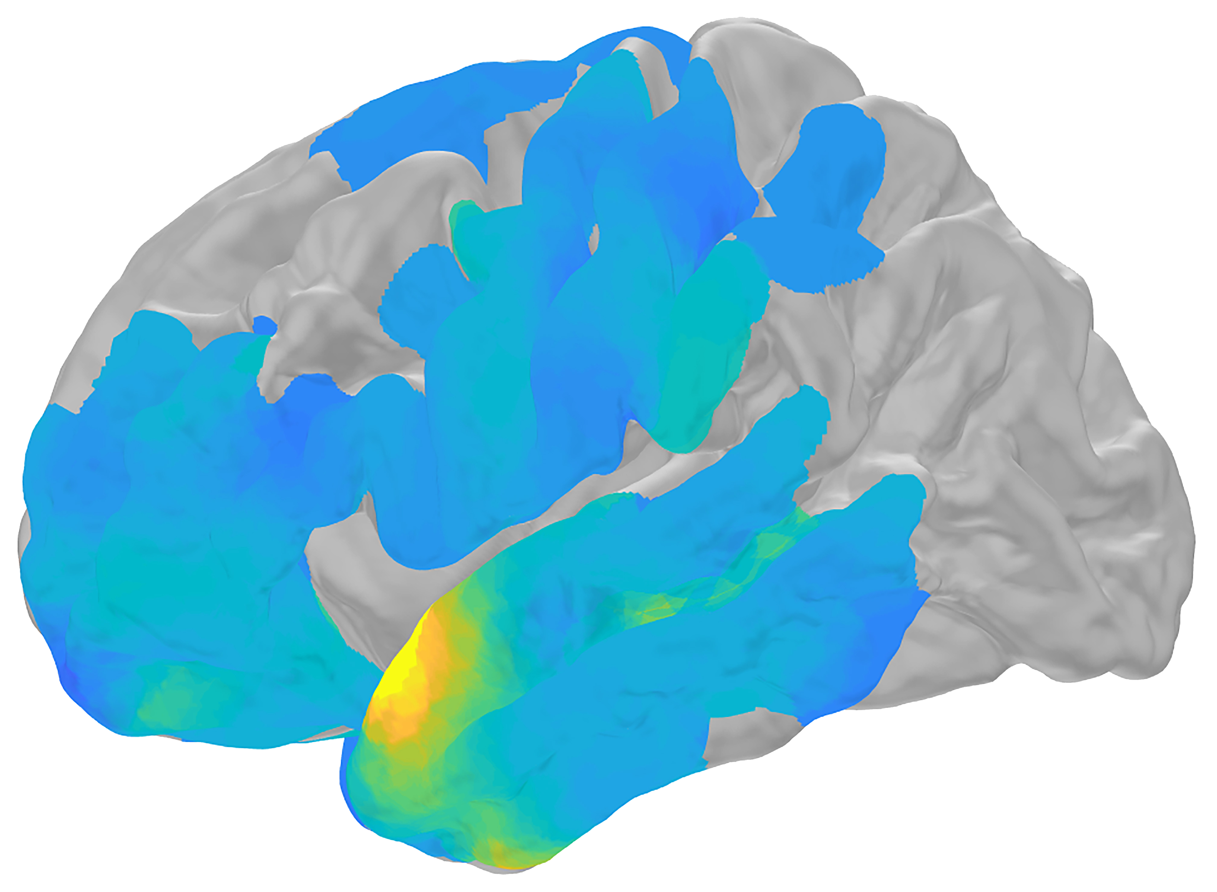 Computer-generated brain scan.