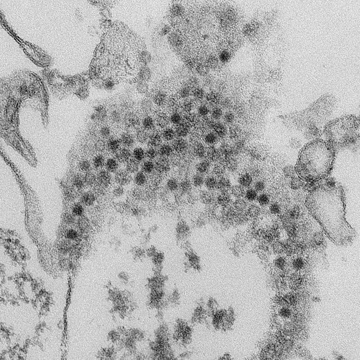 Microscopic image of enterovirus-D68