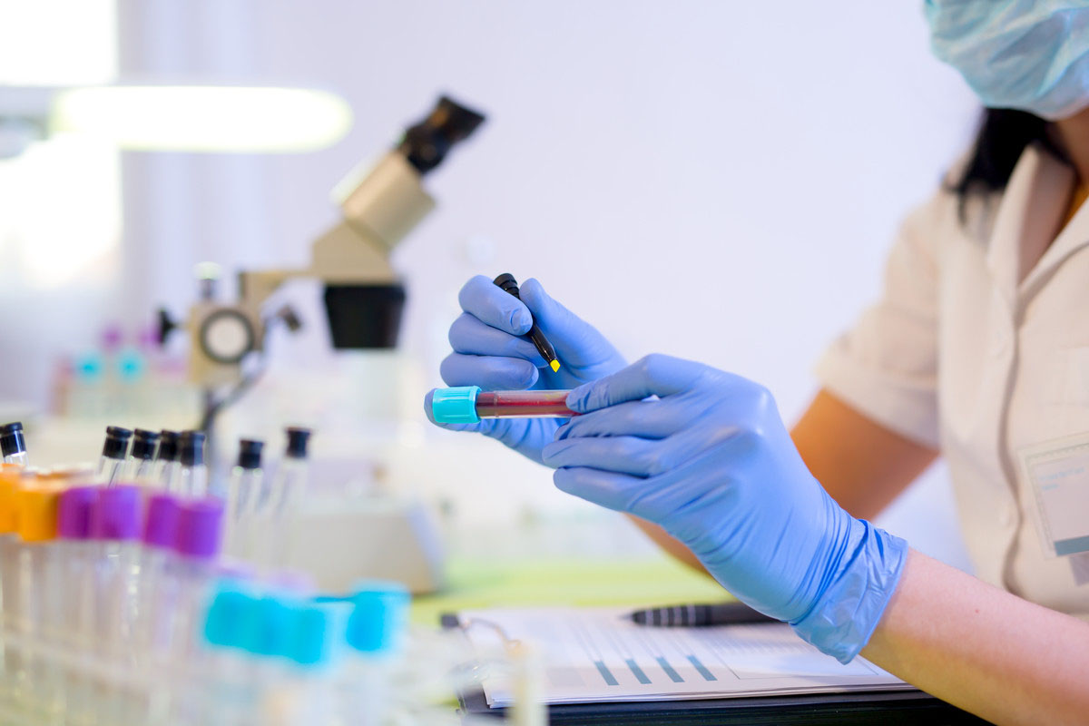 A technician writing on the label of a test tube containing a blood sample