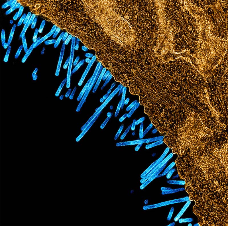 A colorized, transmission electron micrograph showing a swine influenza virus particles (blue) attached to and budding off a cell (orange).