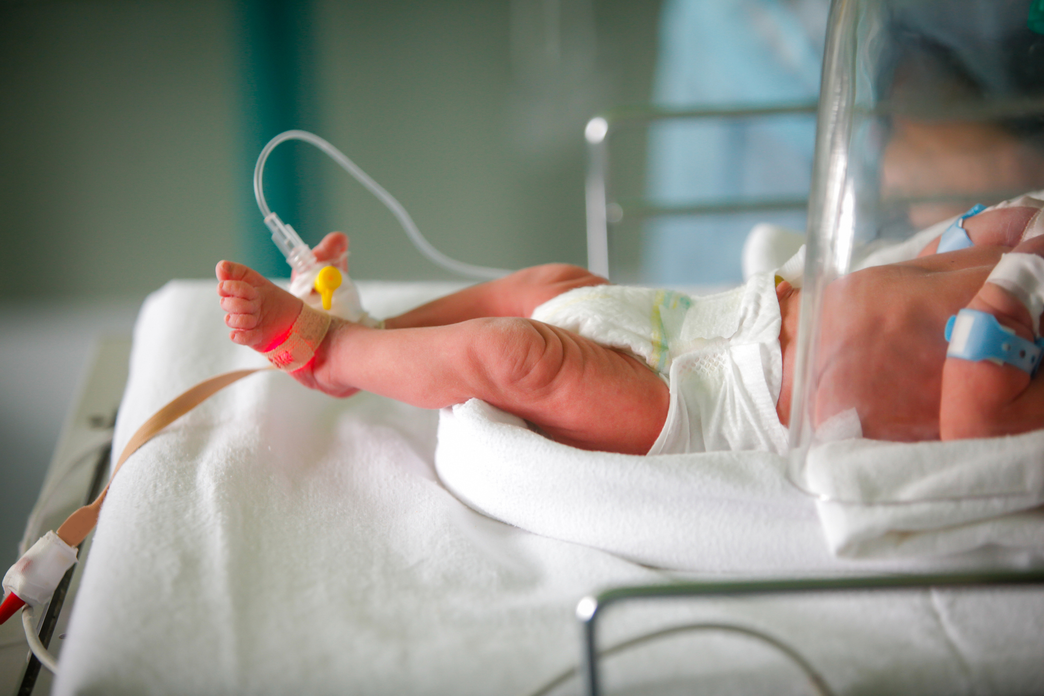 An infant in the hospital