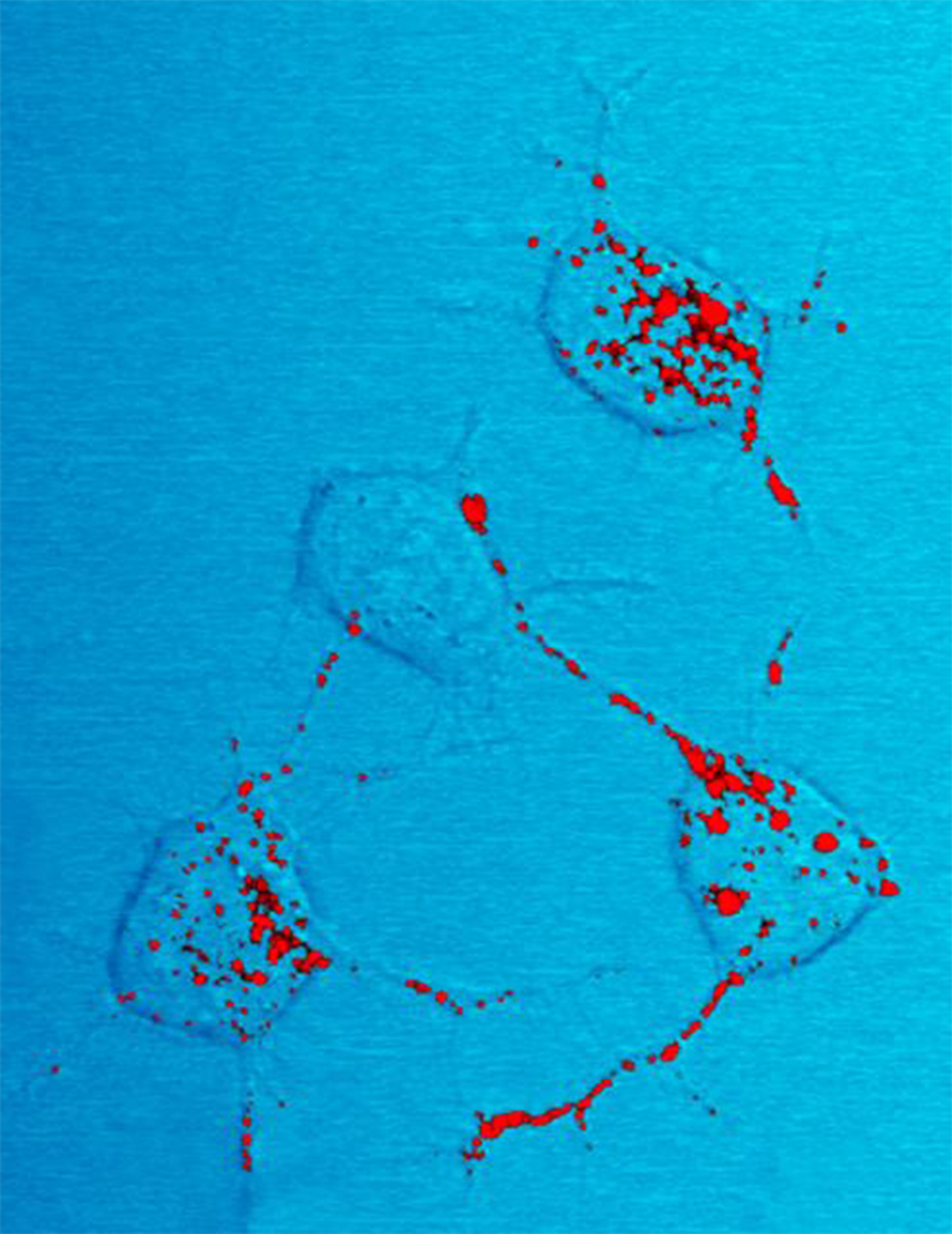 Prion protein, shown in red.