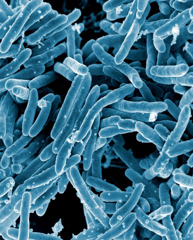Scanning electron micrograph of Mycobacterium tuberculosis bacteria, which cause tuberculosis